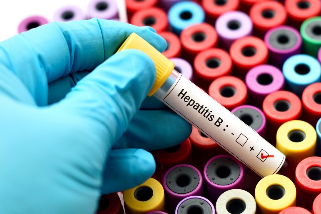 El nuevo medicamento que podría cambiar la lucha contra la hepatitis B: pacientes logran controlar el virus sin tratamiento