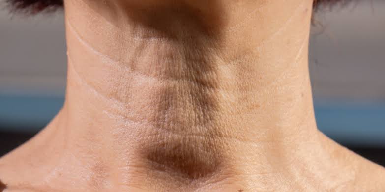 ¿Por qué el cuello envejece más rápido? Las claves para prevenir la flacidez y las arrugas